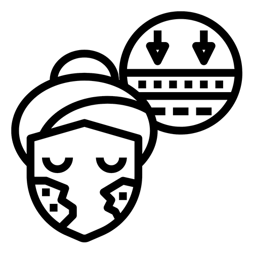 01 MELASMA CHEMICAL PEELING