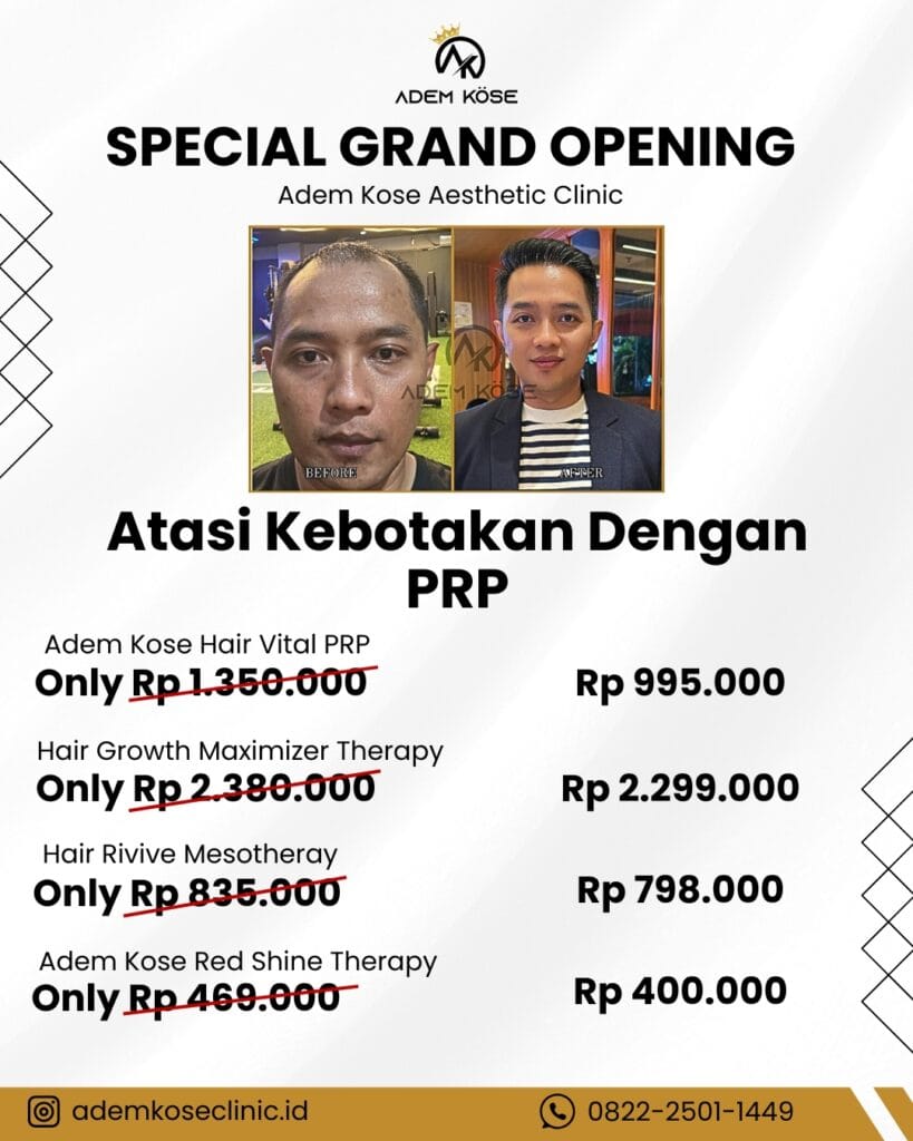 Promo PRP di Adem Kose Indonesia