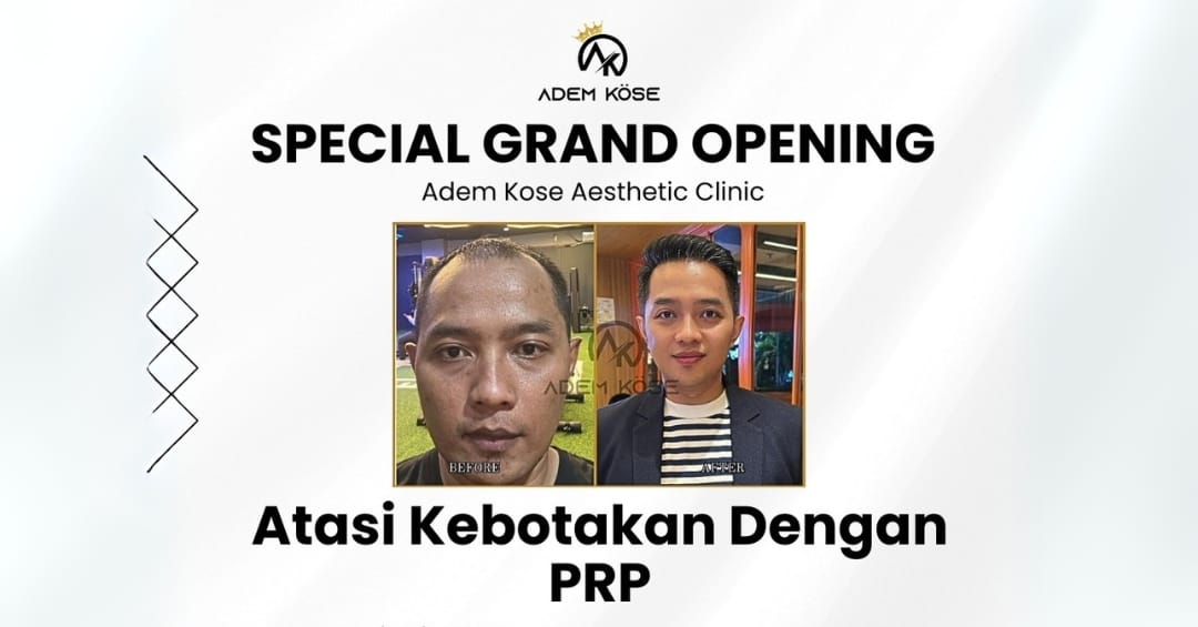 Promo PRP